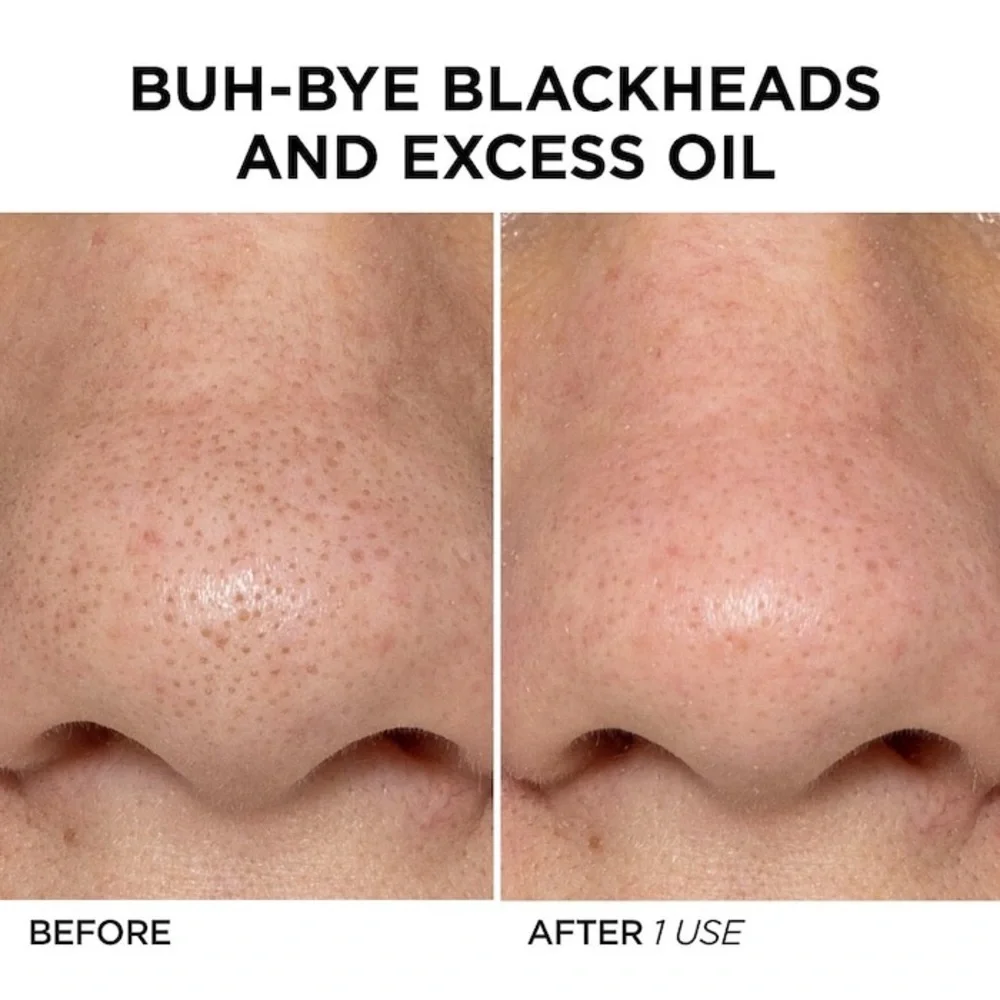 BeautyBio Pore Cleansing Tool - Picture 5 of 7